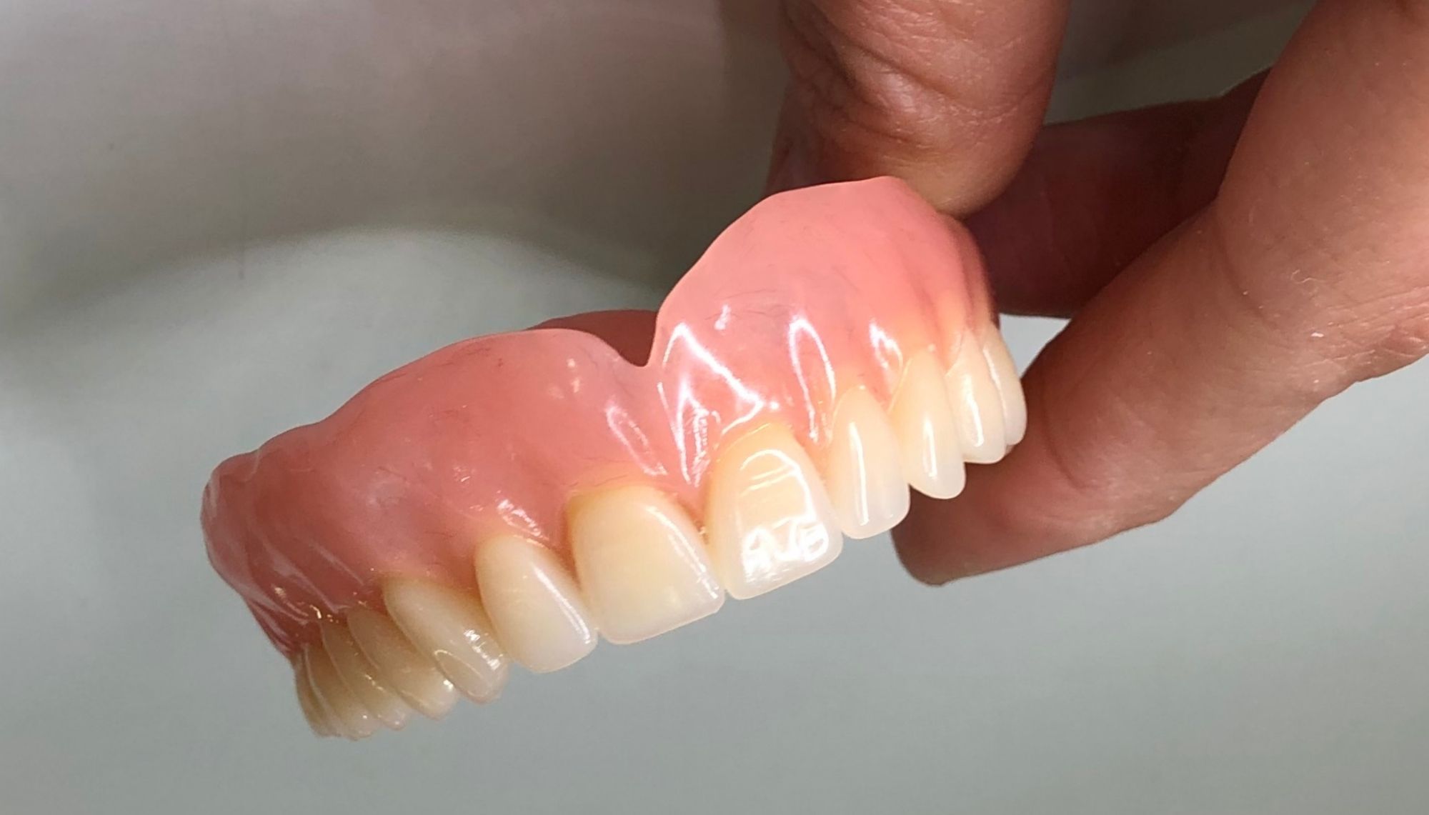 Prótesis Dentales Removibles - Murcia | Laboratorio Dental Rebeca Giménez