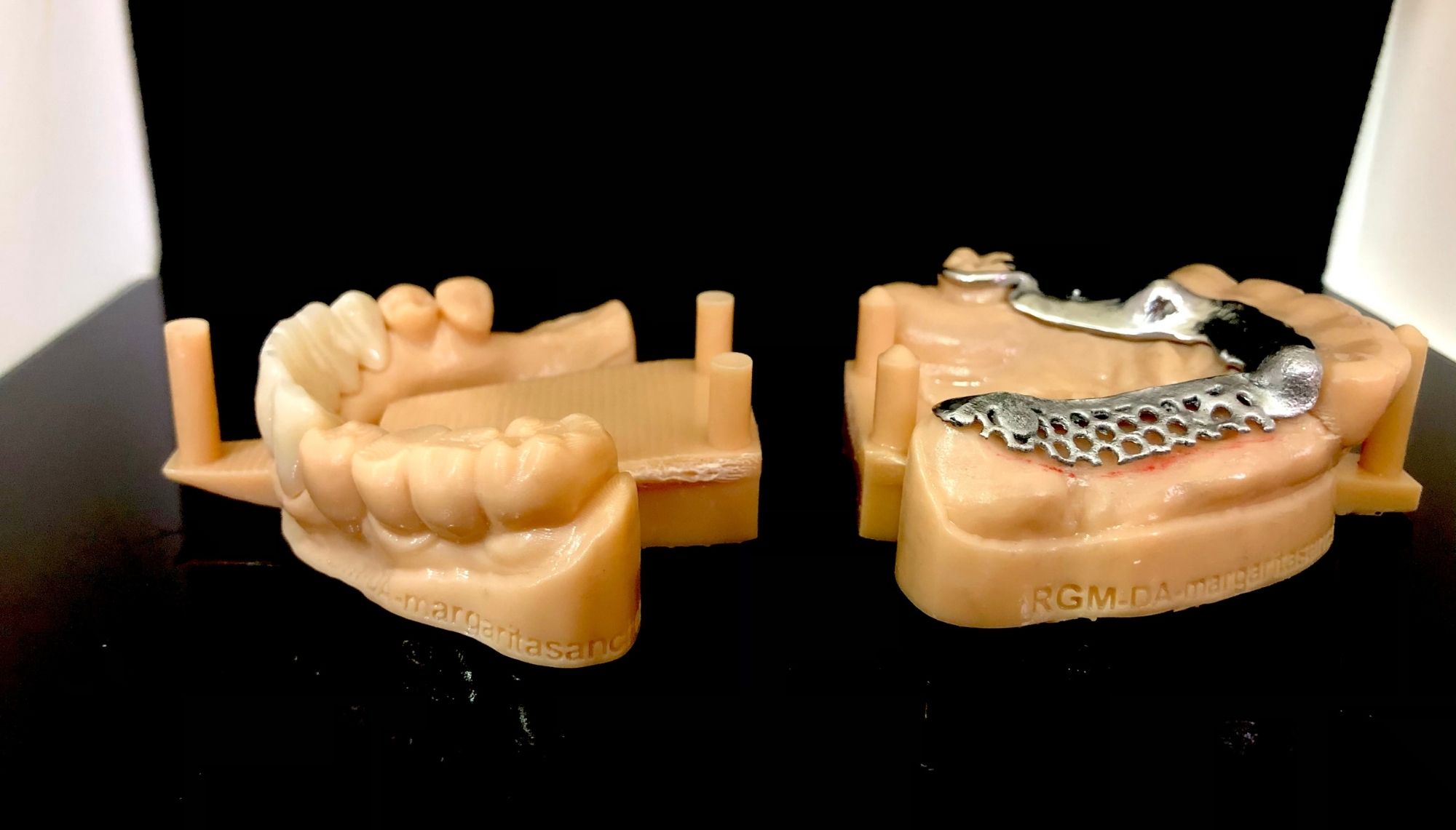 Esqueléticos Cad-Cam - Murcia | Laboratorio Dental Rebeca Giménez