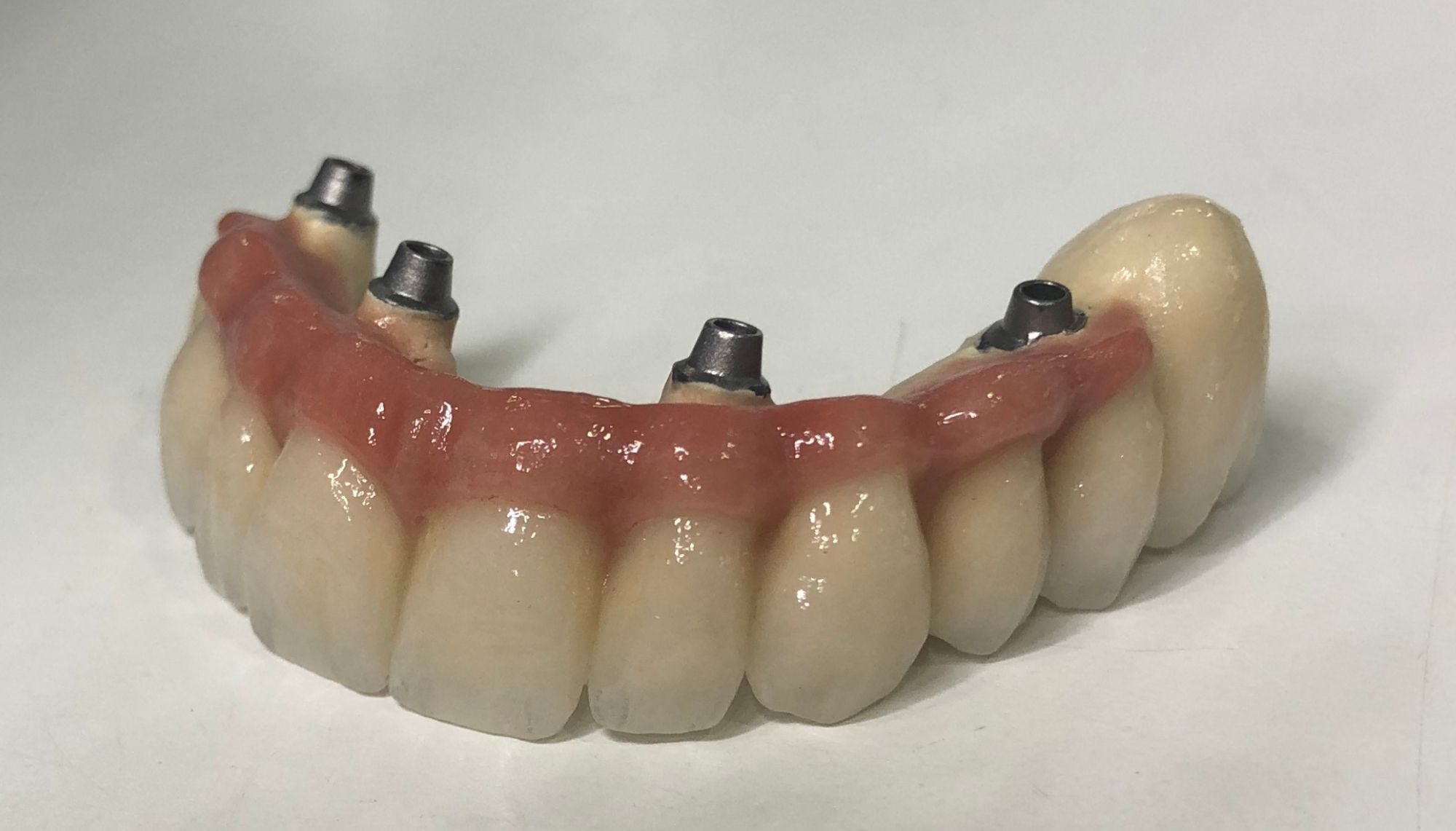 Hibrida Cerámica - Prótesis Fijas | Laboratorio Dental Rebeca Giménez