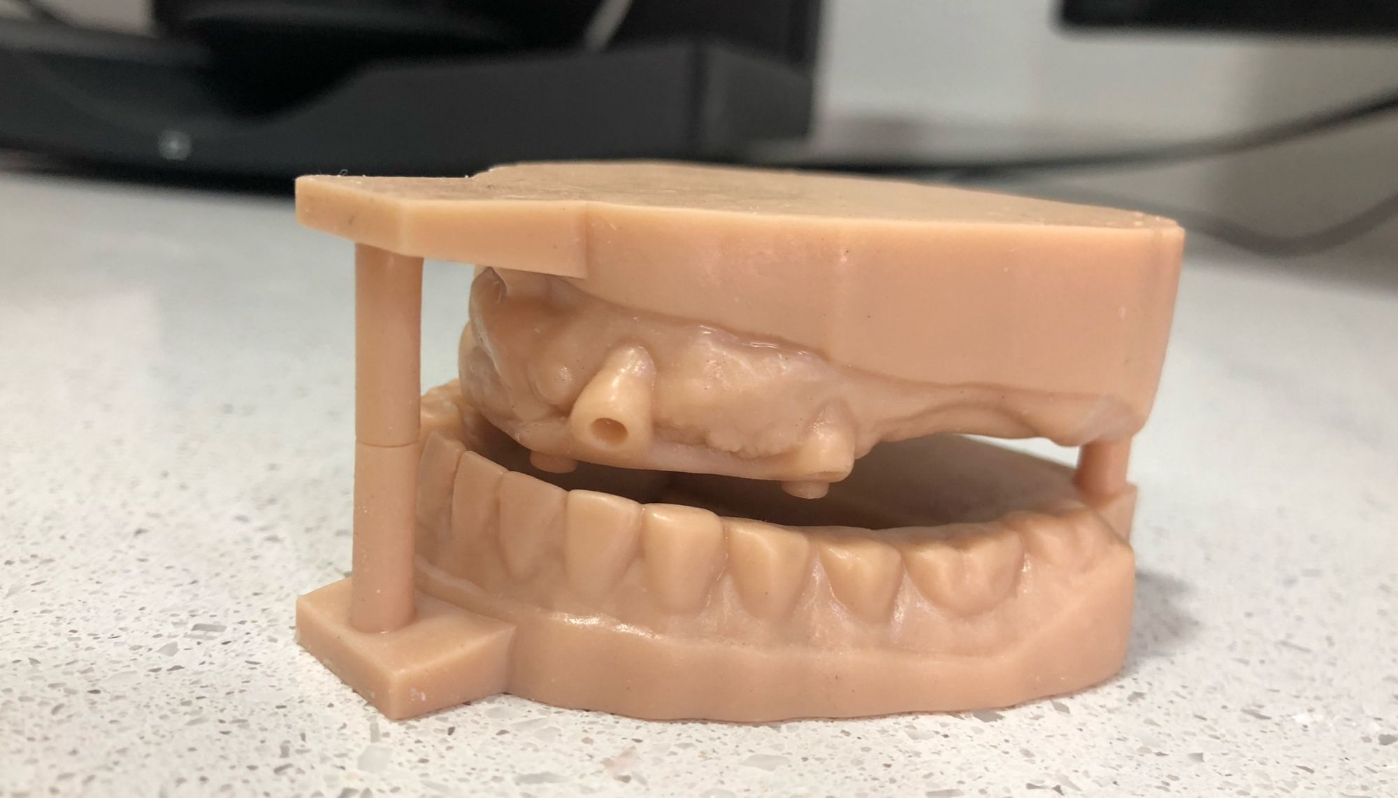 Modelos en 3D | Laboratorio Dental Rebeca Giménez